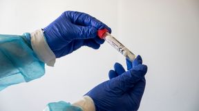 Polski Związek Lekkiej Atletyki wydał oświadczenie ws. potwierdzonego przypadku koronawirusa