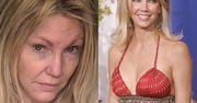 Heather Locklear znów wylądowała na odwyku: "Nie traktuje niczego poważnie. Wciąż dużo pije"