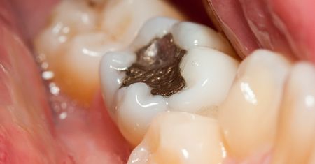 Zakaz wchodzi w życie 1 stycznia. Tego już nie zrobisz u dentysty