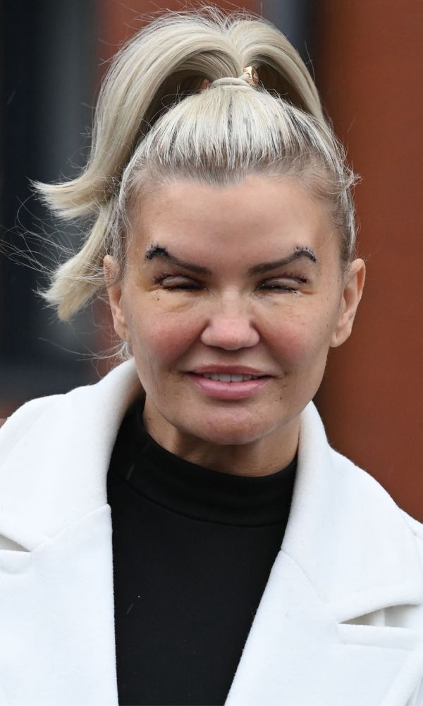 Kerry Katona
