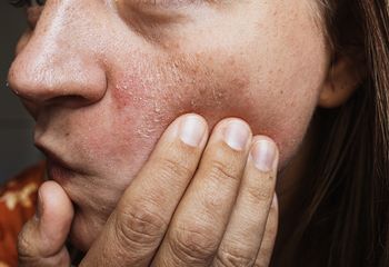 Najlepsze sera nawilżające po lecie. Przesuszona skóra ci podziękuje