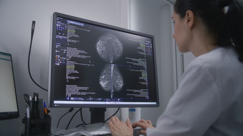 Mammograficzne skany tkanek piersi na ekranie komputera