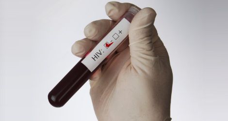 Test na HIV w 15 minut, za 3 złote
