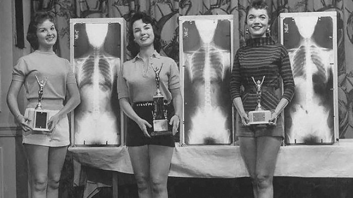 Zdjęcia rentgenowskie różnych rzeczy i stworzeń. Zobacz, jak wyglądają w środku 1