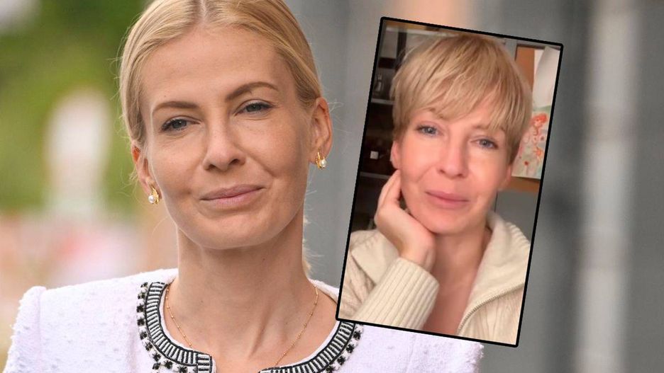Edyta Pazura mówi o swoich problemach z włosami