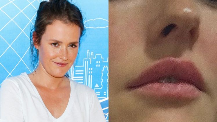 Internautka zapytała Olgę Frycz, czy powiększyła sobie usta