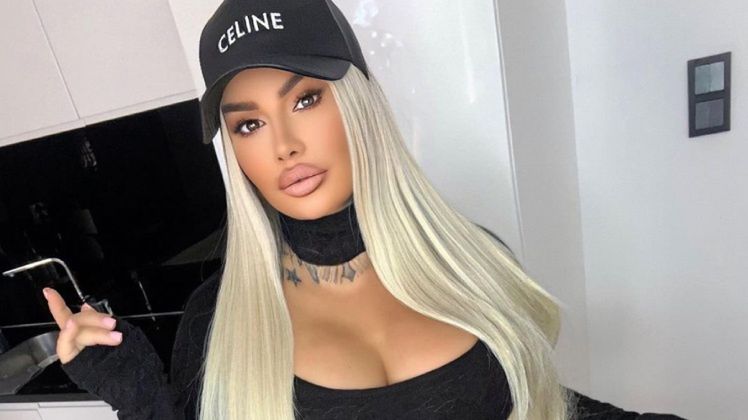 Laluna pochwaliła się efektami operacji zmniejszenia żołądka 