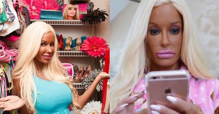 Amerykańska "matka-Barbie": "Dzieci są dumne z tego, co OSIAGNĘŁAM dzięki chirurgii!"