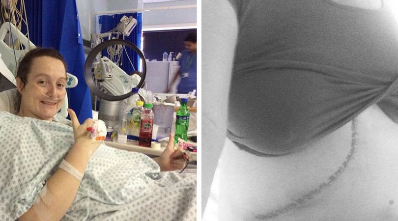 Cara podobnie jak jej ojciec zachorowała na raka jelit. Lekarze usunęli jej część jelita oraz wątroby