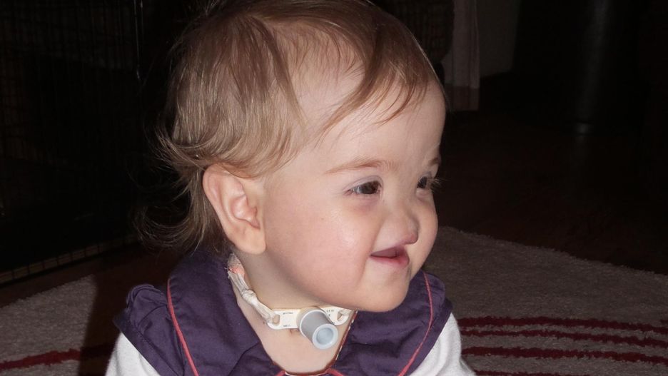 Urodziła się bez nosa. Co słychać u Tessy Evans?