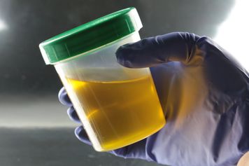 Te bakterie produkują testosteron. Nowy trop w terapii raka prostaty