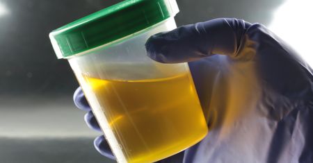 Te bakterie produkują testosteron. Nowy trop w terapii raka prostaty