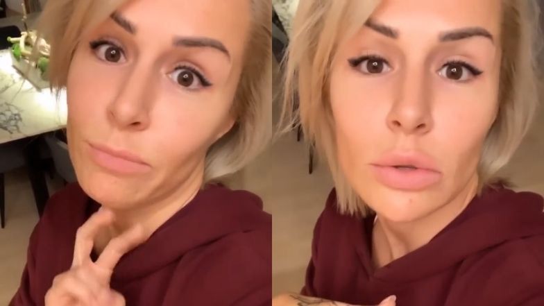 Blanka Lipińska planuje powiększenie ust?