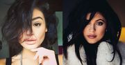 Honey znów powiększyła usta? Chce wyglądać jak Kylie Jenner!