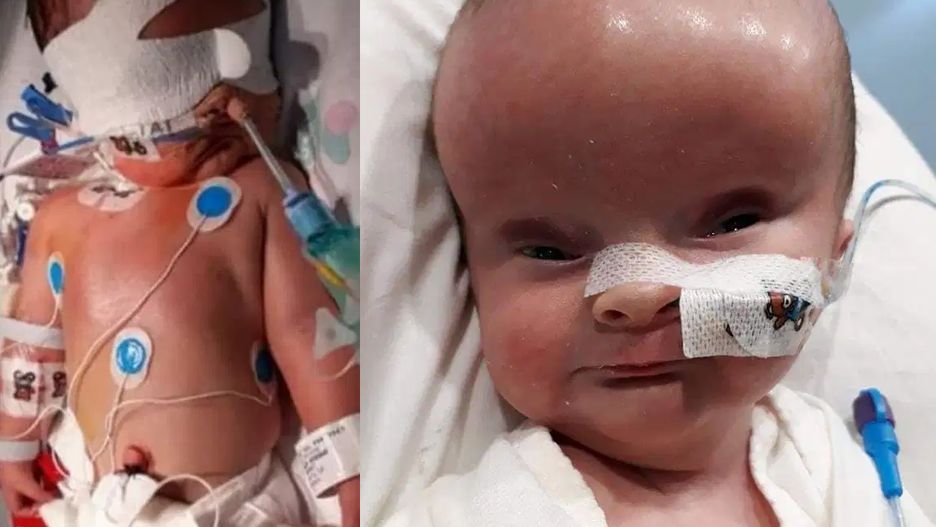 Myah miała liczne wady rozwojowe