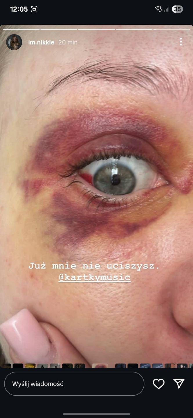 Była dziewczyna oskarża rapera Kartky'ego o przemoc i zdrady