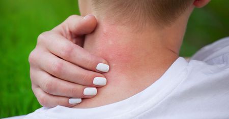 Uważaj na latające kleszcze. Strzyżak jeleni atakuje chmarami
