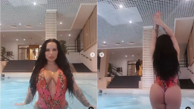 Esmeralda Godlewska chwali się efektami zabiegów w tureckiej klinice