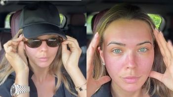 Sandra Kubicka ogłasza: "Za 12 dni operacja PLASTYCZNA. Będę nowy człowiek"
