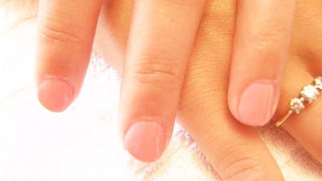 Pierwsze objawy grzybicy paznokci 1