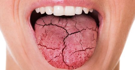 Choroba Behceta – przyczyny, objawy, diagnostyka i leczenie