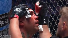 Poważny uraz twarzy Tomasza Romanowskiego po walce z Piotrem Kuberskim