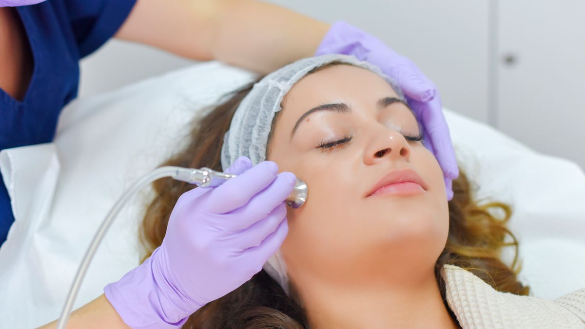 Zabieg mikrodermabrazji polega na stopniowym złuszczaniu górnych warstw naskórka.