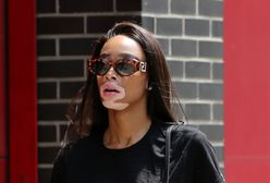 Czarnoskóra modelka z bielactwem. Winnie Harlow wybiera kultowe Vansy