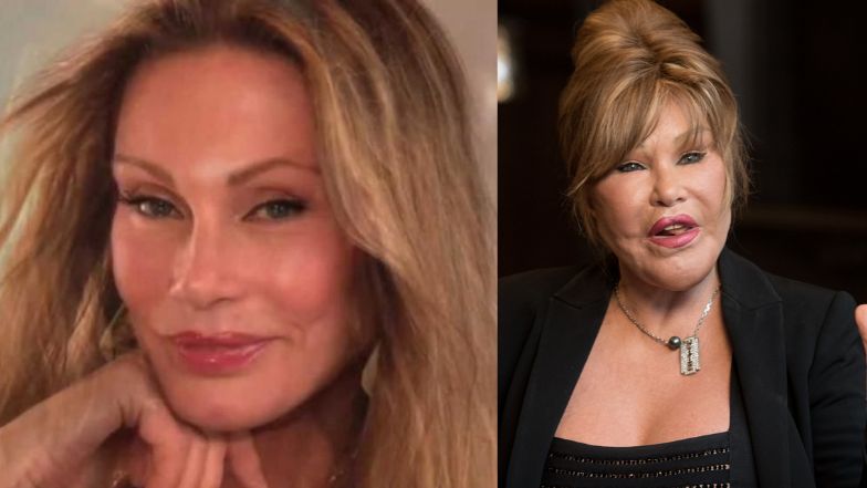 Jocelyn Wildenstein