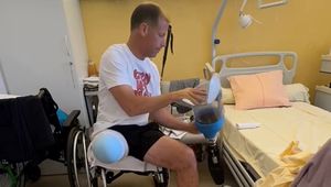 Powiedział lekarzom, by amputowali mu nogę. Po roku wrócił na szczyt