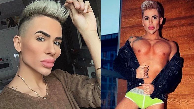 Michał Przybyłowicz - polski "Żywy Ken" chwali się efektami operacji