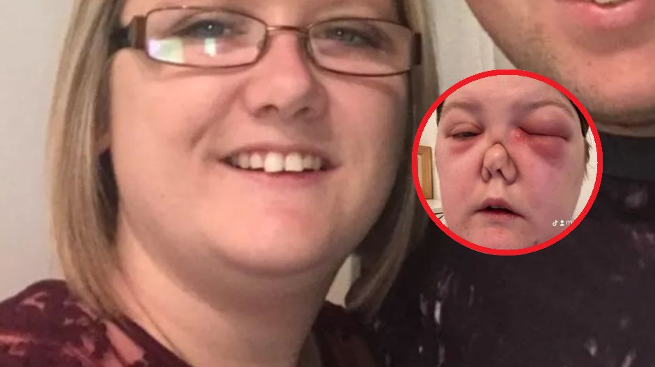 Myślała, że umrze. Choroba zmieniła ją na zawsze