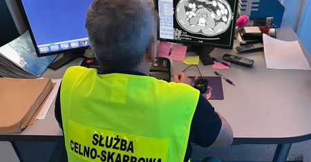 Kokaina w żołądku: Nigeryjczyk próbował przemycić 1,25 kg na Lotnisku Chopina