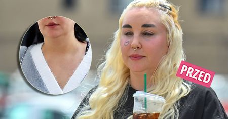 Amanda Bynes opowiedziała o swojej walce z nadwagą. Wiadomo, ile udało jej się schudnąć