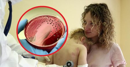 Fala zakażeń groźną bakterią w przedszkolach. Sanepid szuka przyczyny