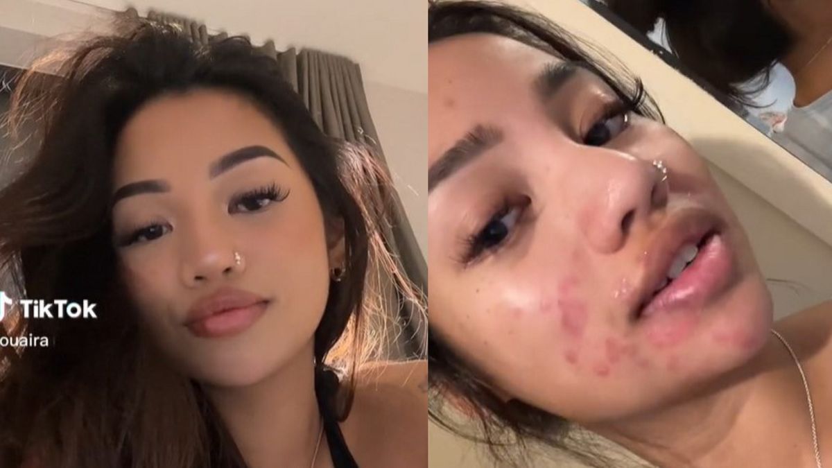 Miała piękną twarz. Jeden błąd sprawił, że już tak nie wygląda