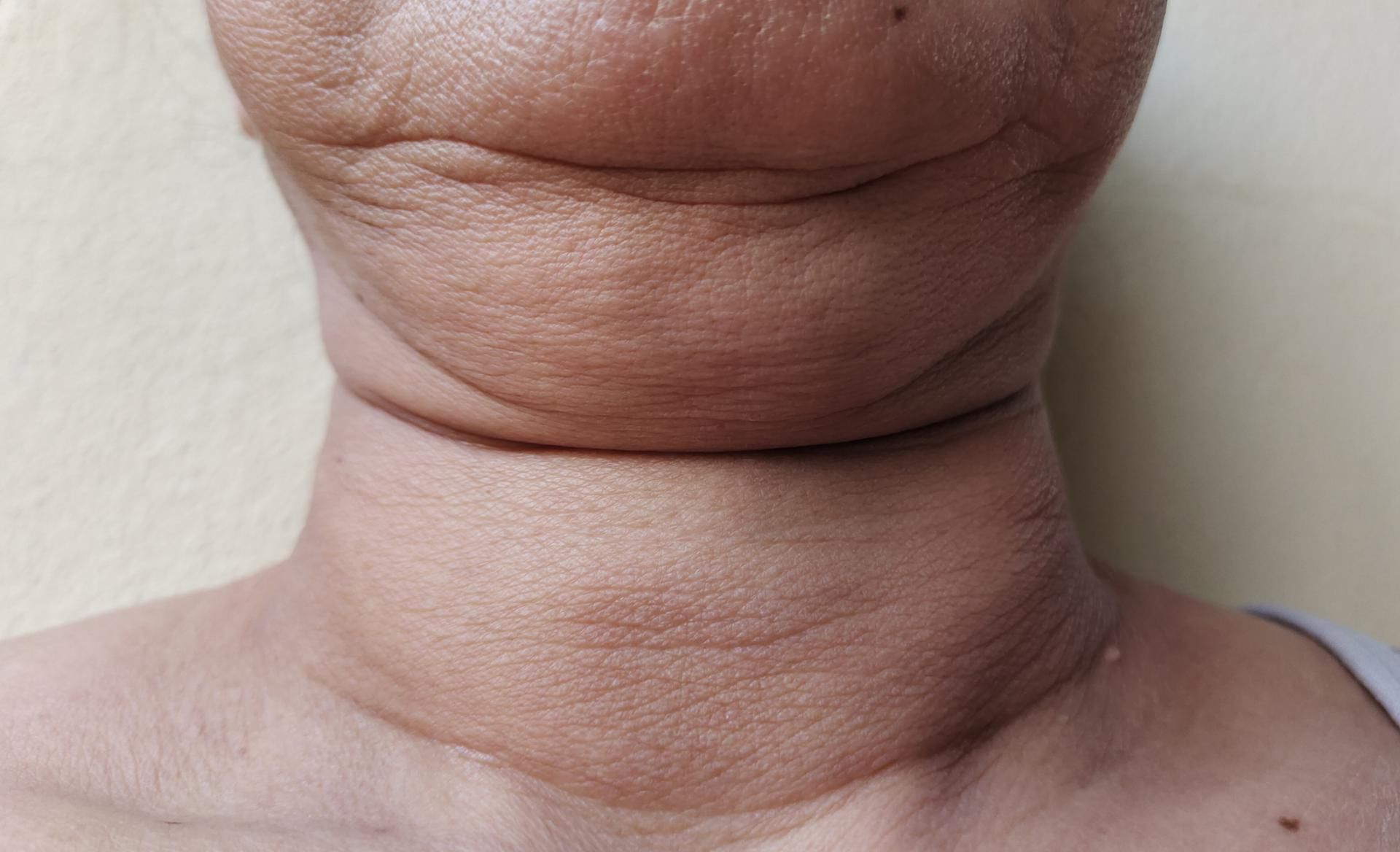 Stosowany w niedoczynności tarczycy lek może wpływać na gęstość kości