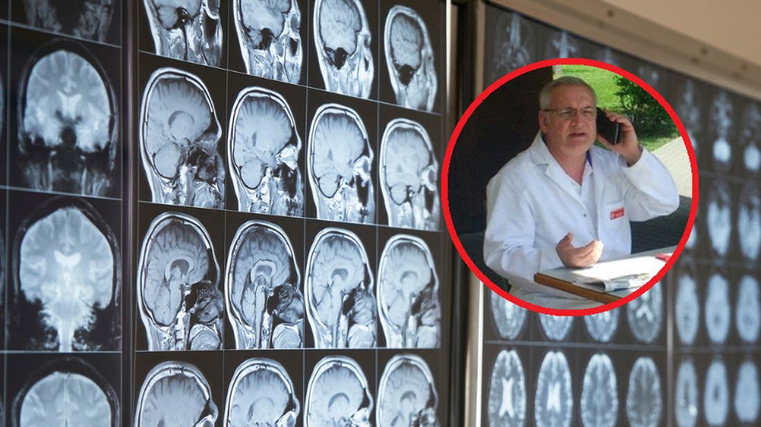 Tak odmłodzisz mózg. Neurolog ma ważną radę