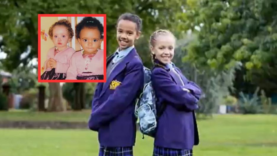 Niesamowite bliźniaczki. Gdy miała 10 miesięcy, zaczęła się zmieniać