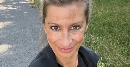 Magdalena Schejbal zaprezentowała się bez makijażu: "Niedoskonała. Z przebarwieniami, piegami"