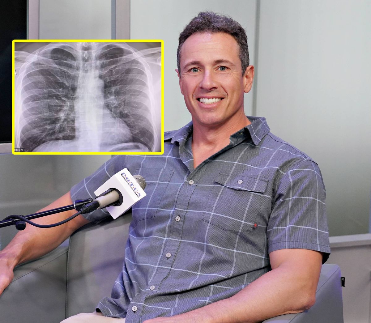 Chris Cuomo, dziennikarz CNN pokazał rentgen swoich płuc. Jest zakażony koronawirusem