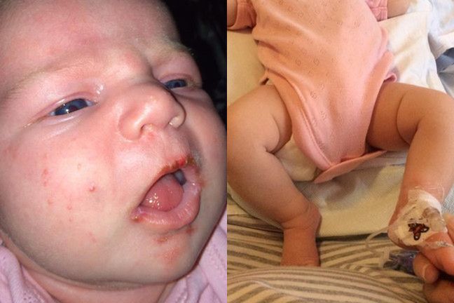 Zdjęcie niemowlaka zostało udostępnione już ponad 45 tys. razy