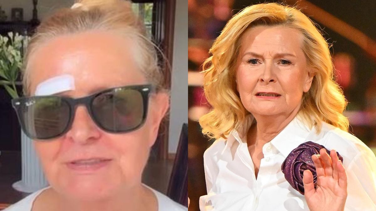 Barbara Bursztynowicz upadła na ulicy