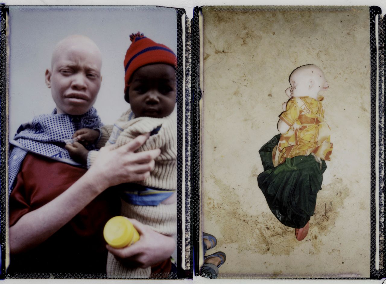 Co mówią sami albinosi o swojej sytuacji? Czy poznałeś ich historie? Któraś z nich utkwiła ci w pamięci szczególnie?