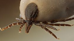 Jak wyjmować kleszcza?