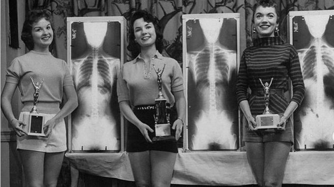 Miss poprawnej postawy