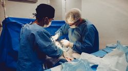 Przeszczep kości - wskazania, przebieg, powikłania, postępowanie po zabiegu