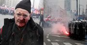 74-letni fotoreporter "Tygodnika Solidarność" POSTRZELONY gumową kulą na Marszu Niepodległości. Policja: "Jest nam PRZYKRO"