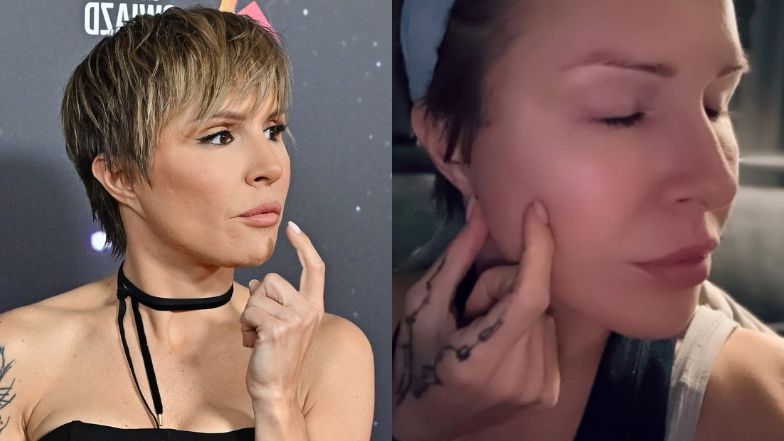 Blanka Lipińska tłumaczy się ze zrobienia liftingu twarzy