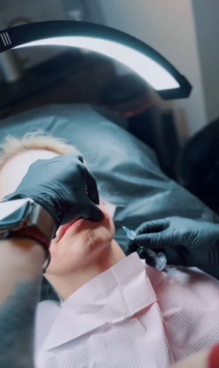 Dominika Tajner pokazała nagranie z zabiegu